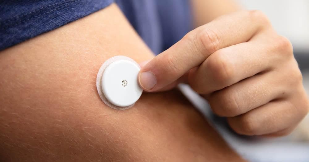 Blood Glucose Monitoring