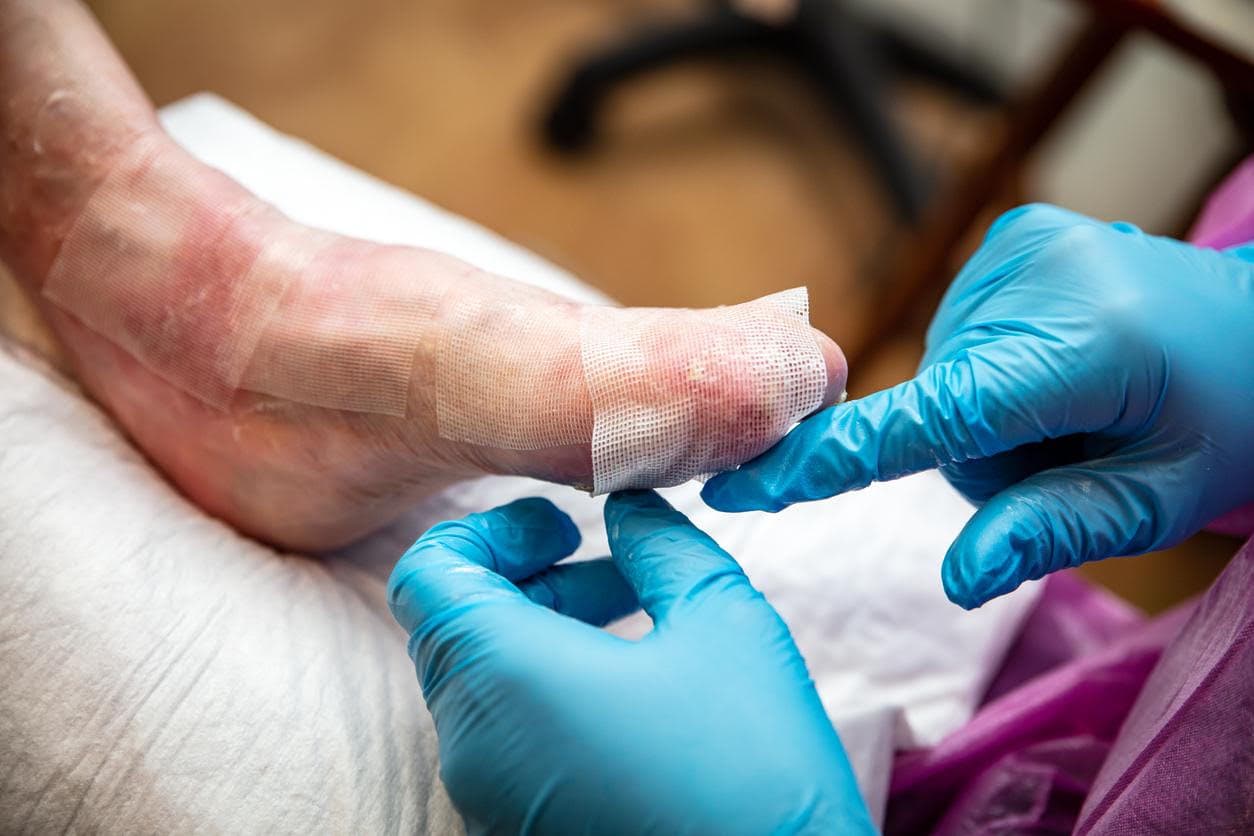 Wound Care and Dressing Changes